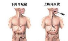 嗜酸性粒细胞性胃肠炎--病理 嗜酸性粒细胞性胃肠炎--病理